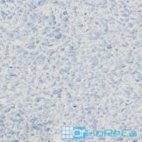 Штукатурка декоративная (обои жидкие) RELIEF 326 ''SILK PLASTER'' 1/6